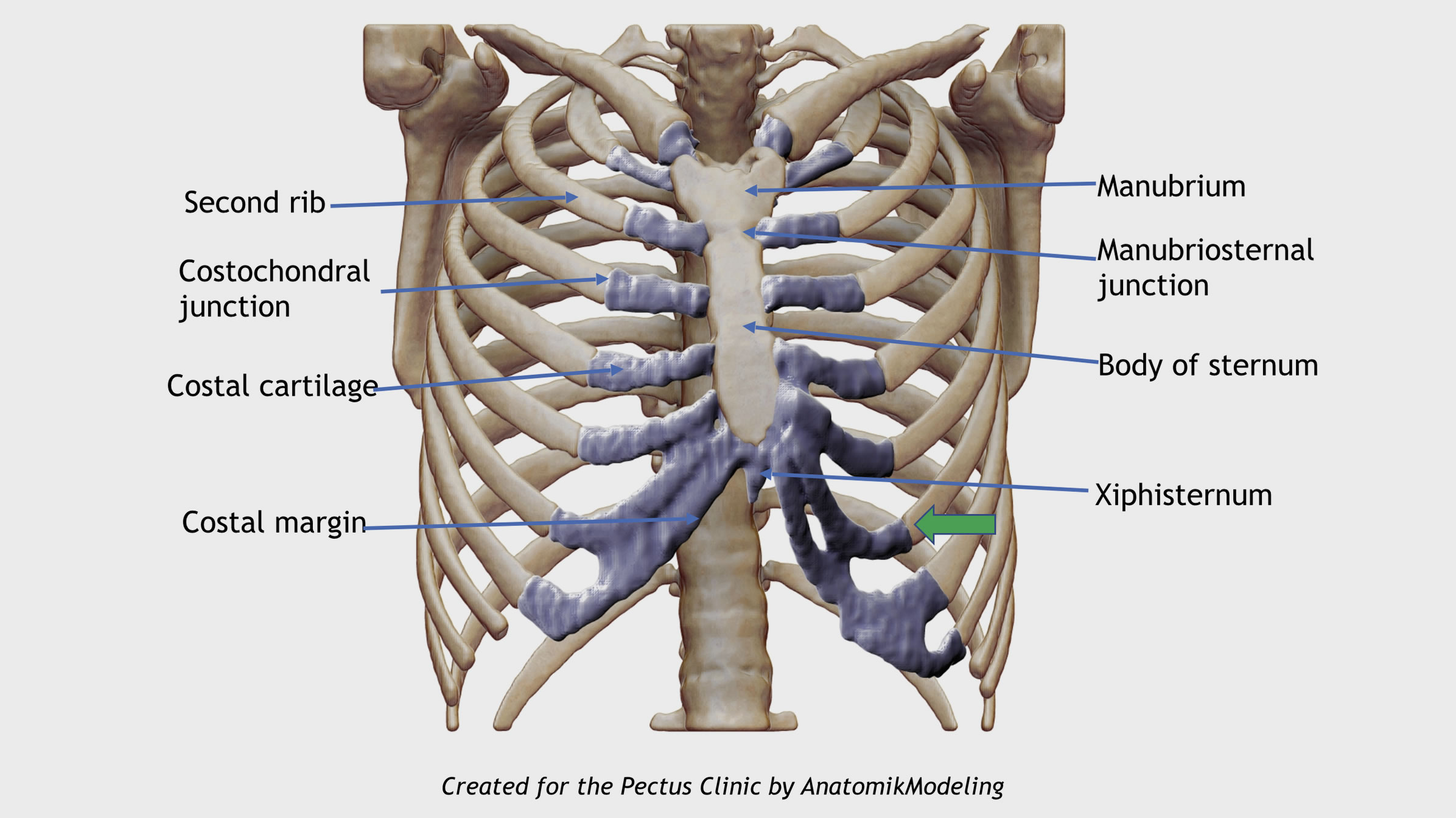 Pectus Conditions | Pectus Clinic