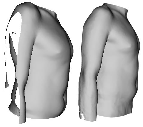 Bracing 3D imaging before and after