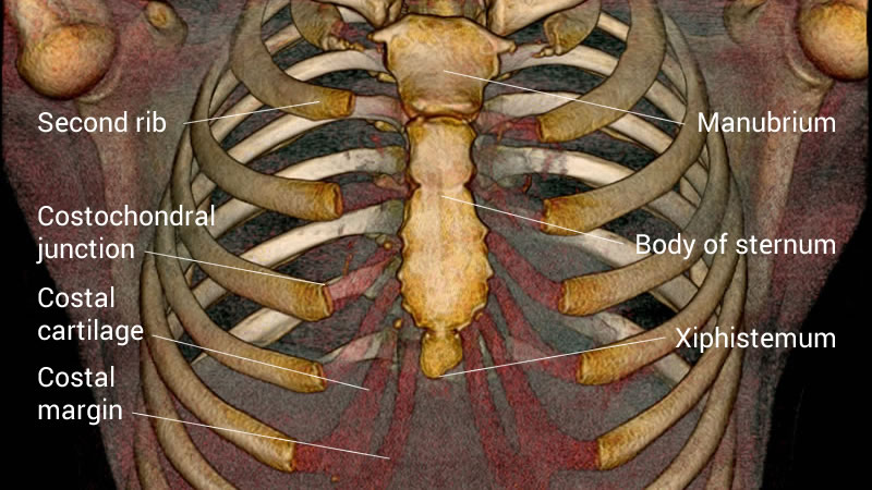 Pectus Conditions | Pectus Clinic