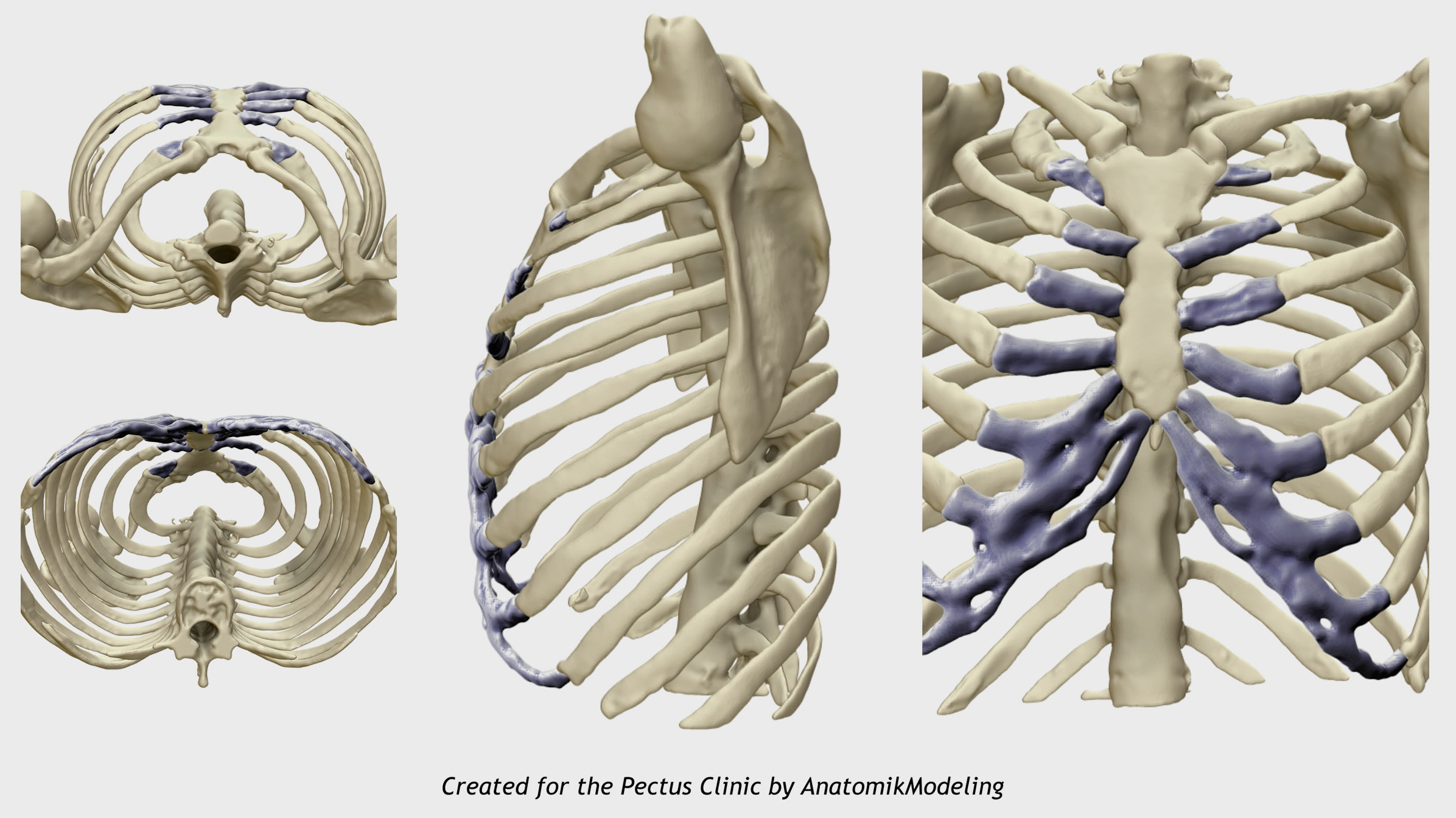 Anterior chest wall structures