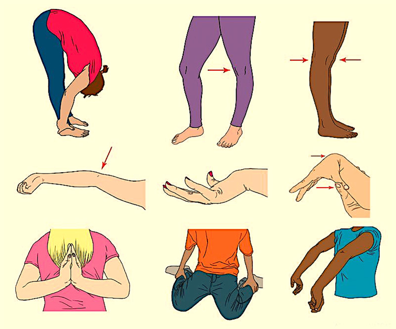 Joint hypermobility that may be associated with Ehlers-Danlos syndrome