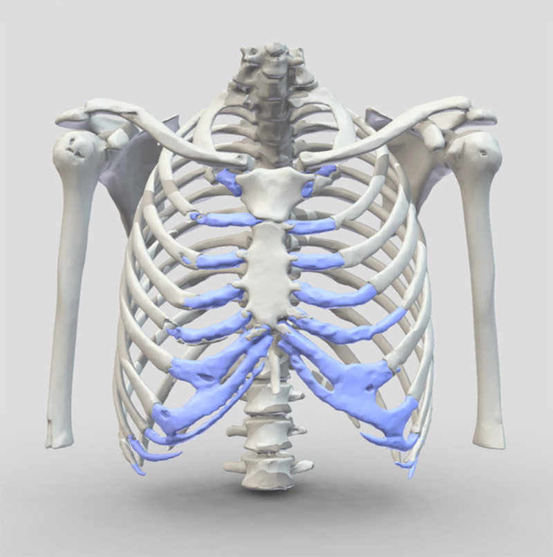 Costal margin is made up of the anterior cartilaginous parts of the lower rib cage