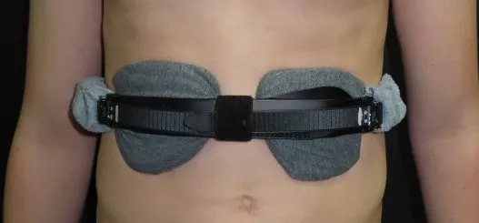 External rib flare brace
