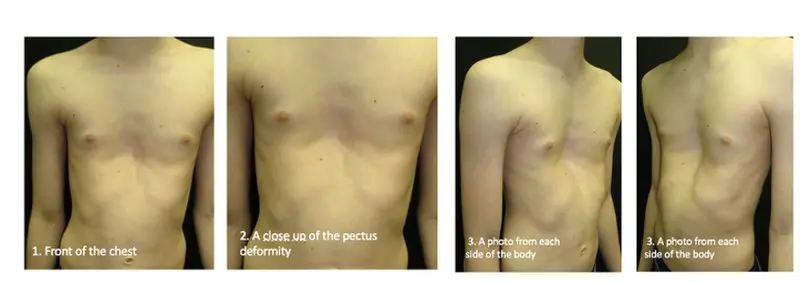 Example clinical photographs