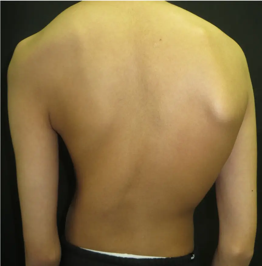 Associated Conditions