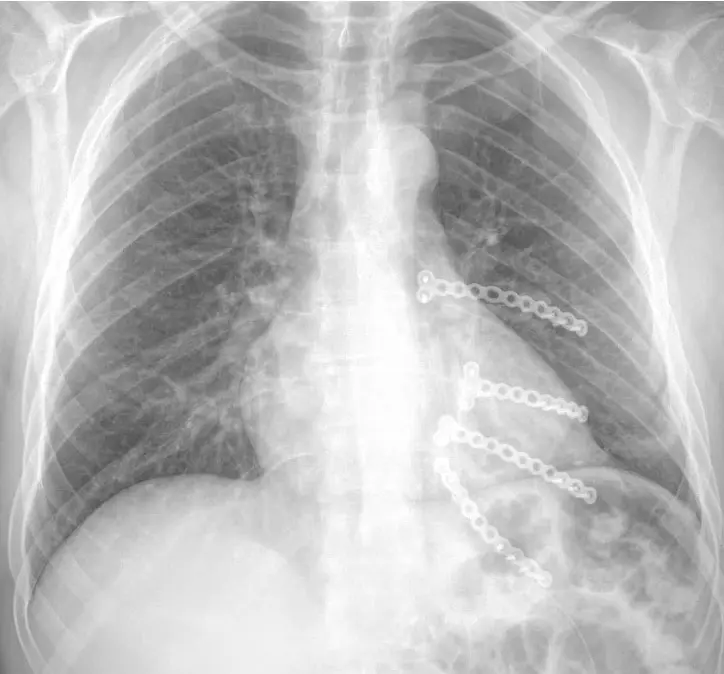 Complex & Revision Surgery