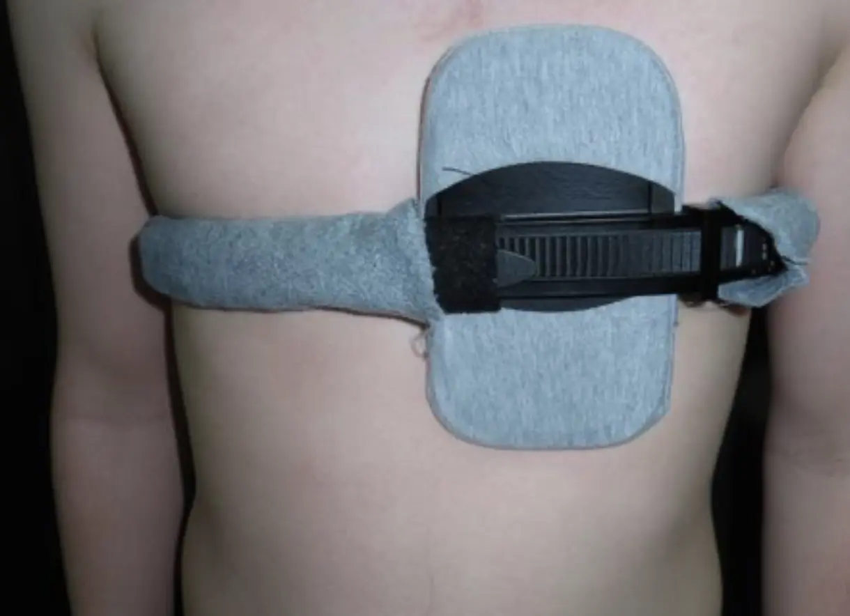 Asymmetric chest wall brace — Pectus Clinic
