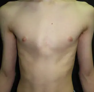 Before — case 1