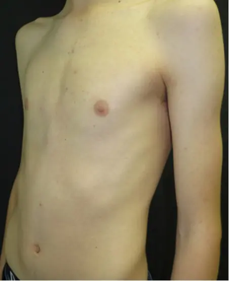 After — case 2