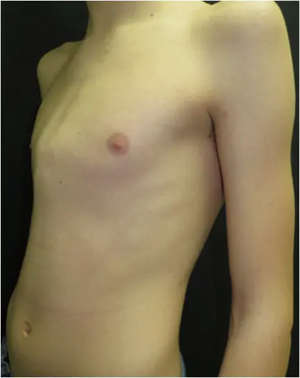 Before — case 2