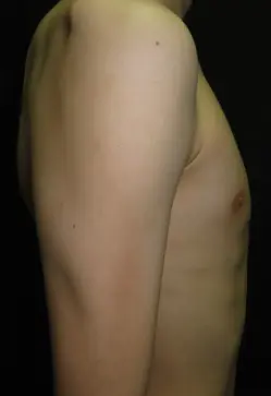 After — case 4