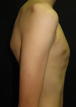 Before — case 4