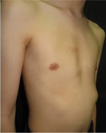 After — case 5