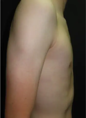 After — case 10