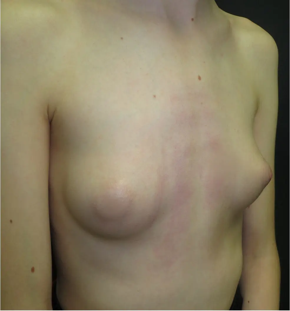 After — case 13