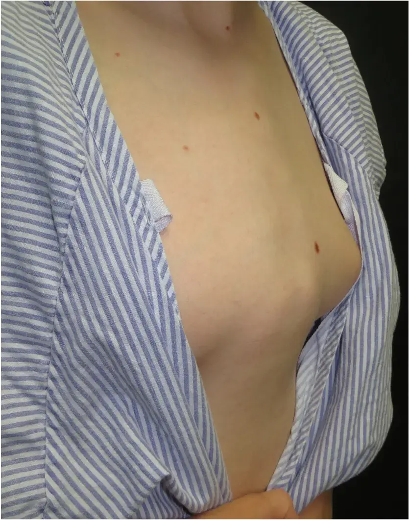 Before — case 13