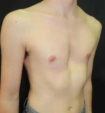 After — case 14