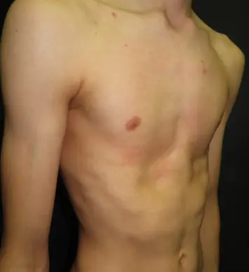 After — case 15