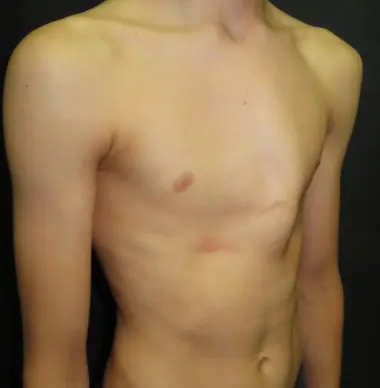 Before — case 15