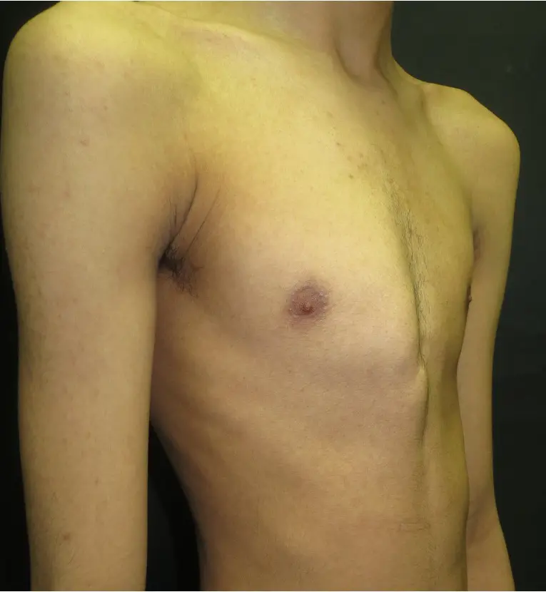 Before — case 17