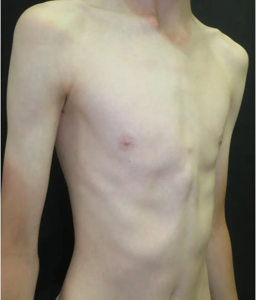 After — case 18
