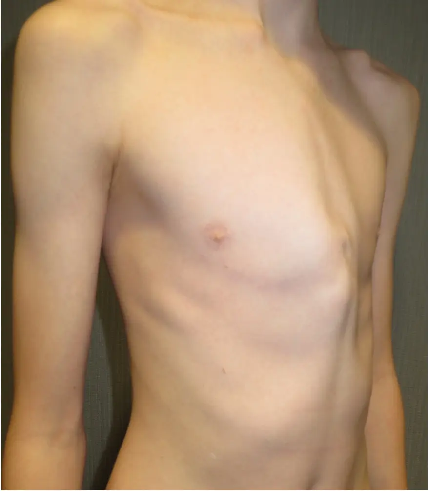 Before — case 18