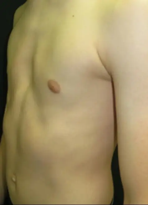 After — case 19