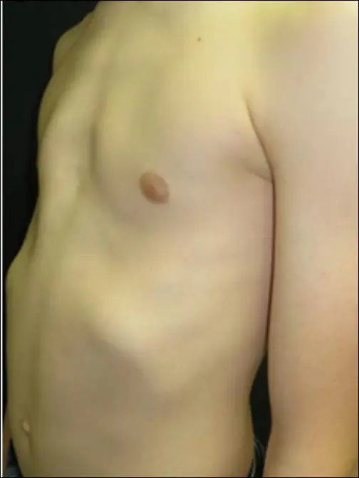 Before — case 19