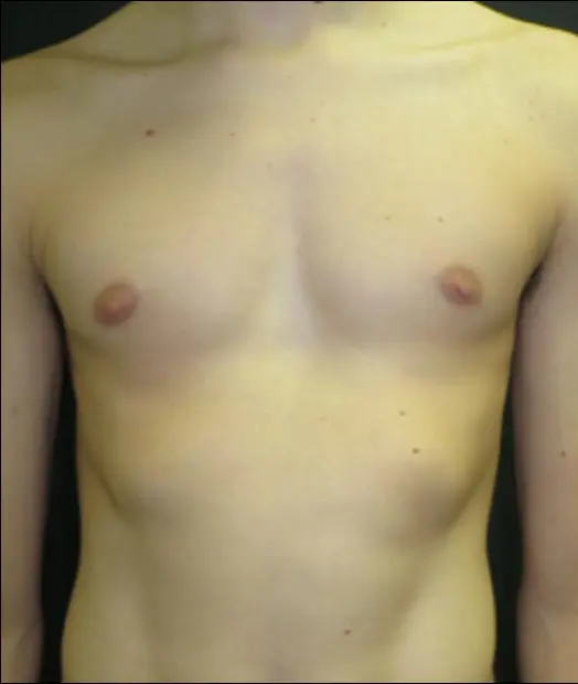 Before — case 20