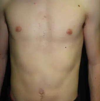 After — case 21