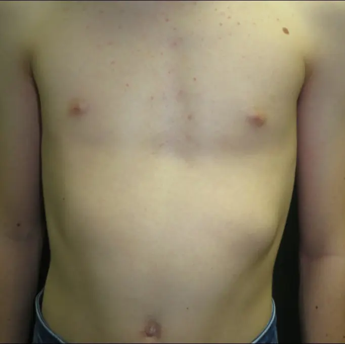 Before — case 21
