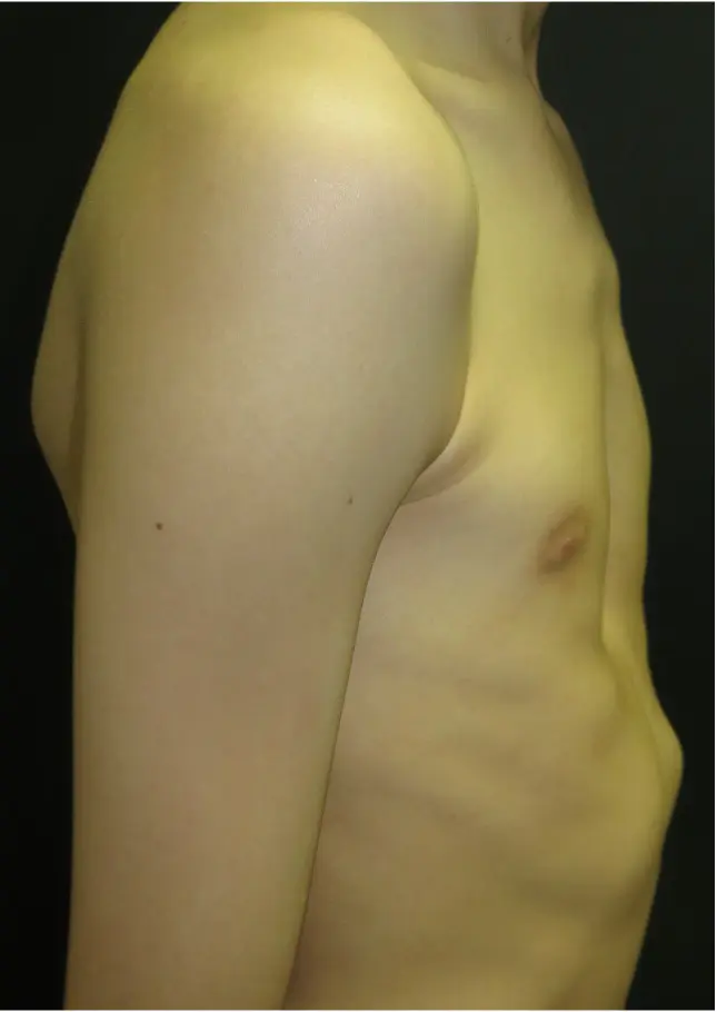 Before — case 22