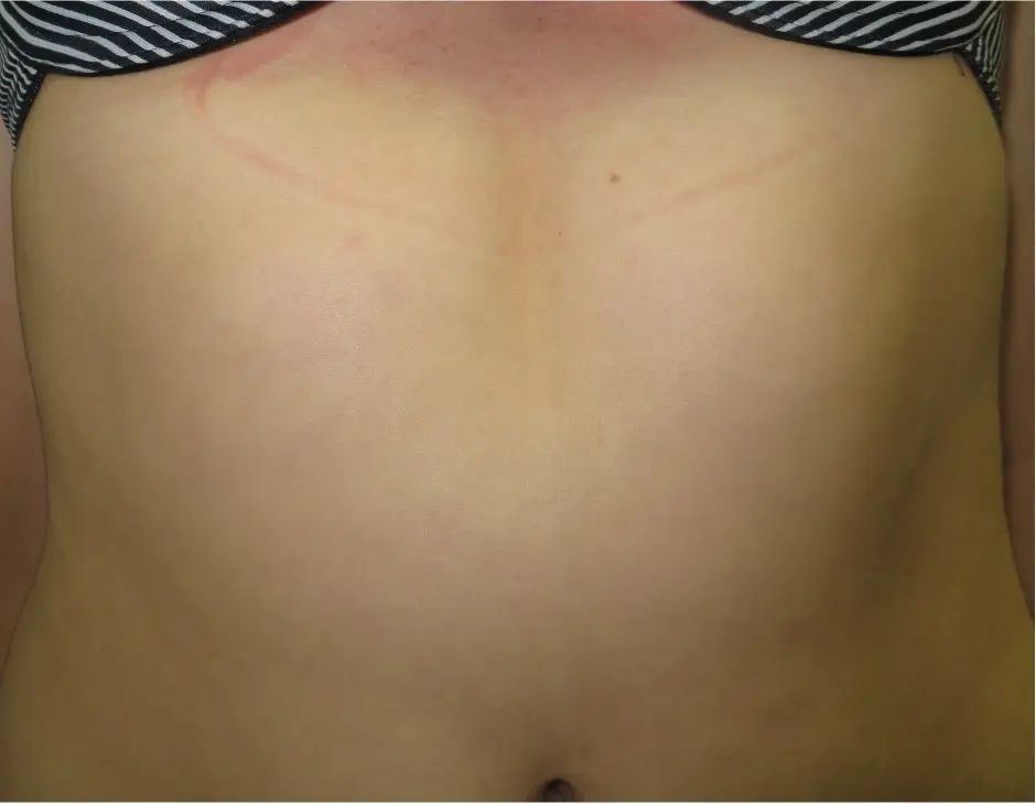 Before — case 23