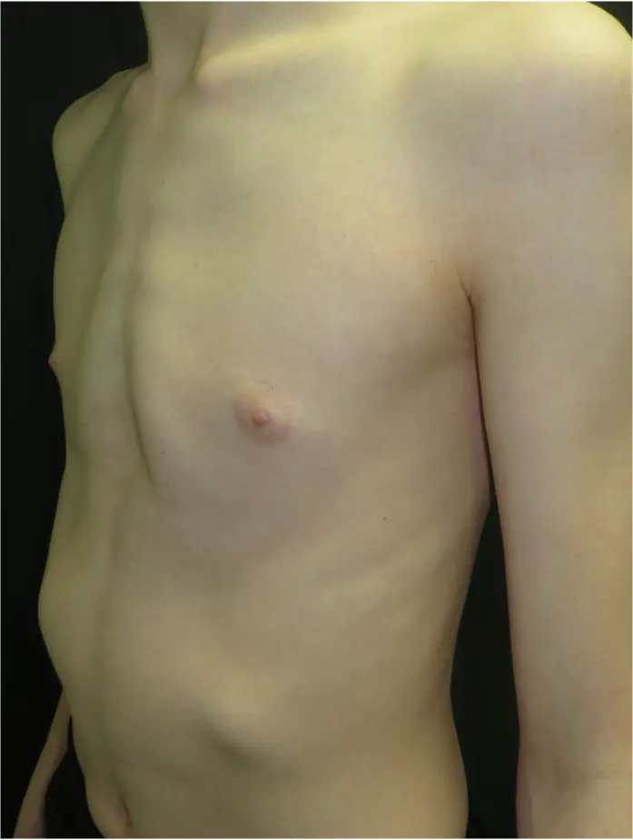 Before — case 24