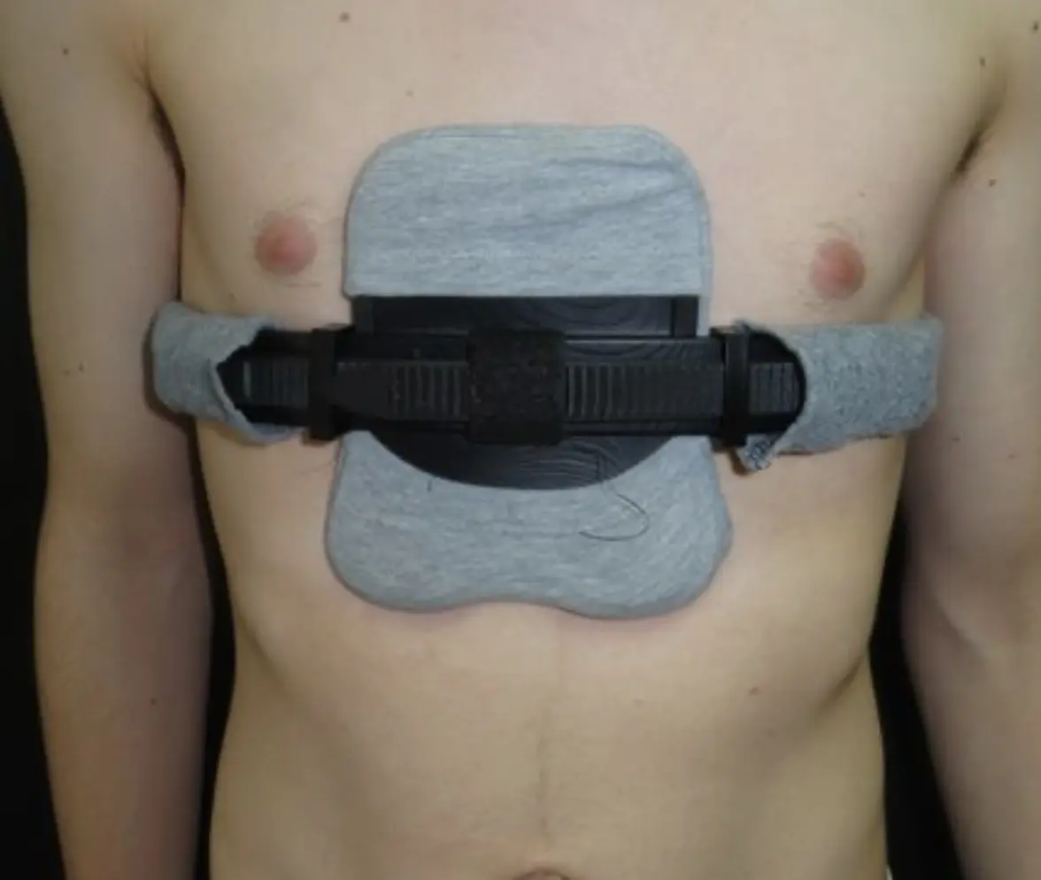 Symmetric chest wall brace — Pectus Clinic