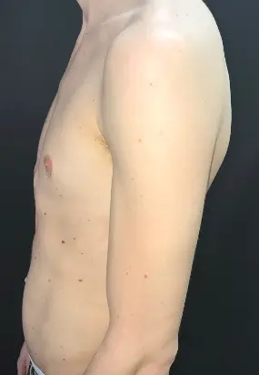 After — case 1