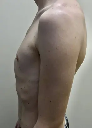 Before — case 1