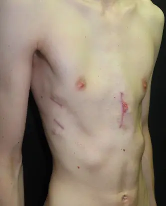 After — case 2