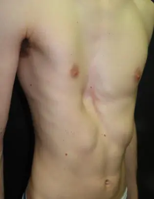 Before — case 2
