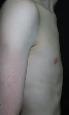 After — case 1