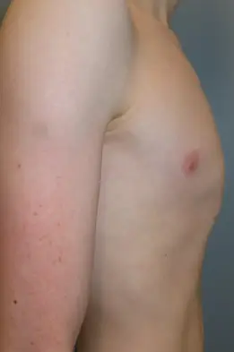 Before — case 1