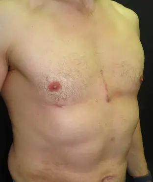 After — case 2