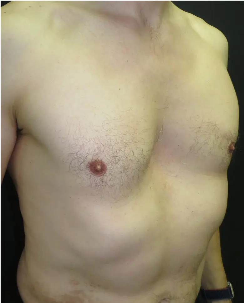 Before — case 2