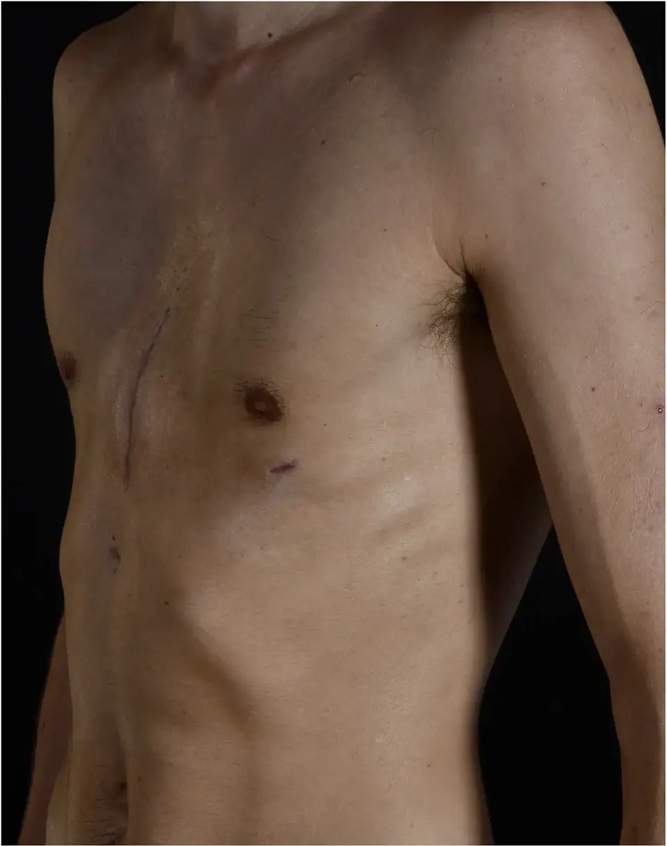 After — case 4