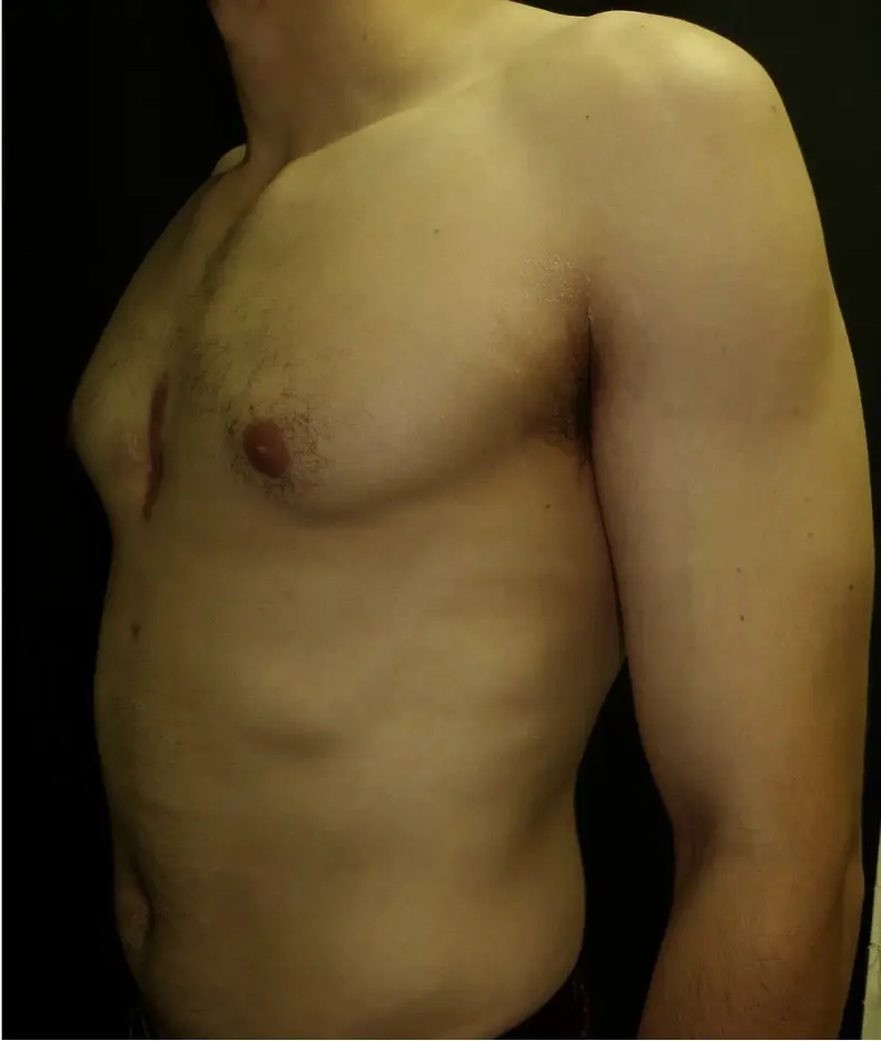 After — case 5