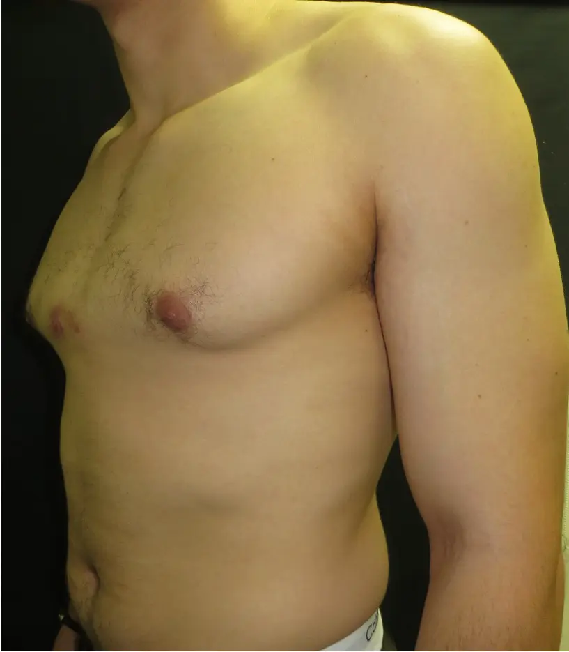 Before — case 5