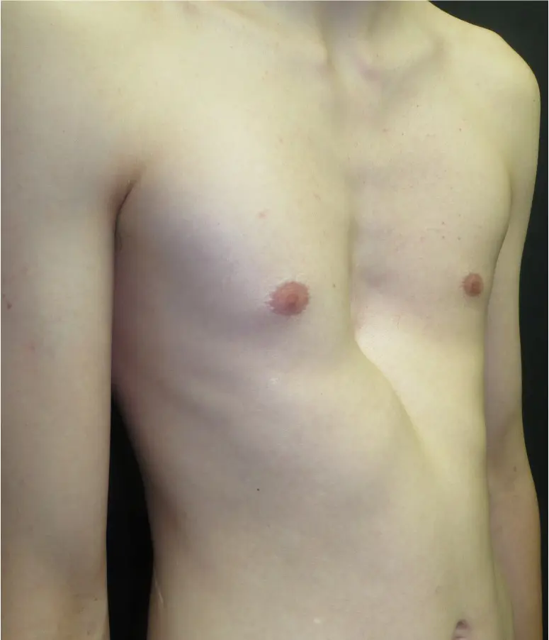 Before — case 6