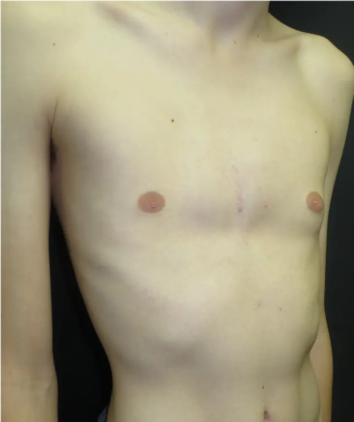 After — case 8
