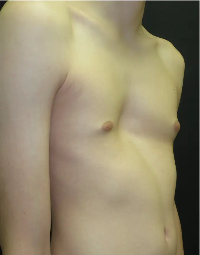 Before — case 8