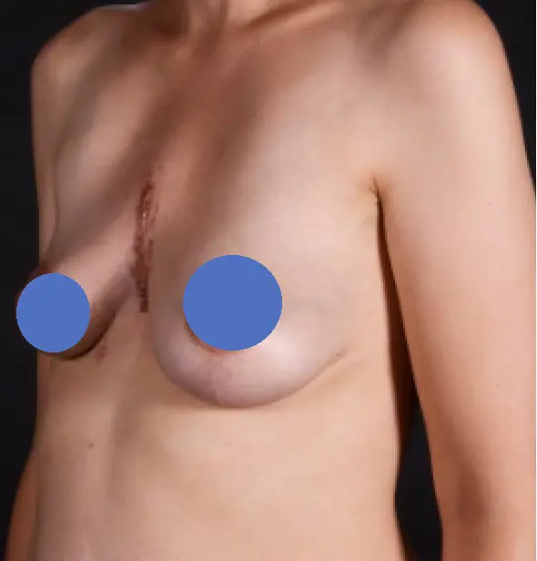 Before — case 9